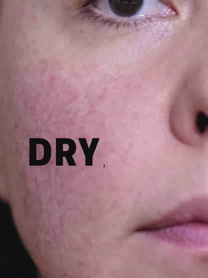 Hydra-Balance Face Wash – With Vitamin E & Rose Geranium